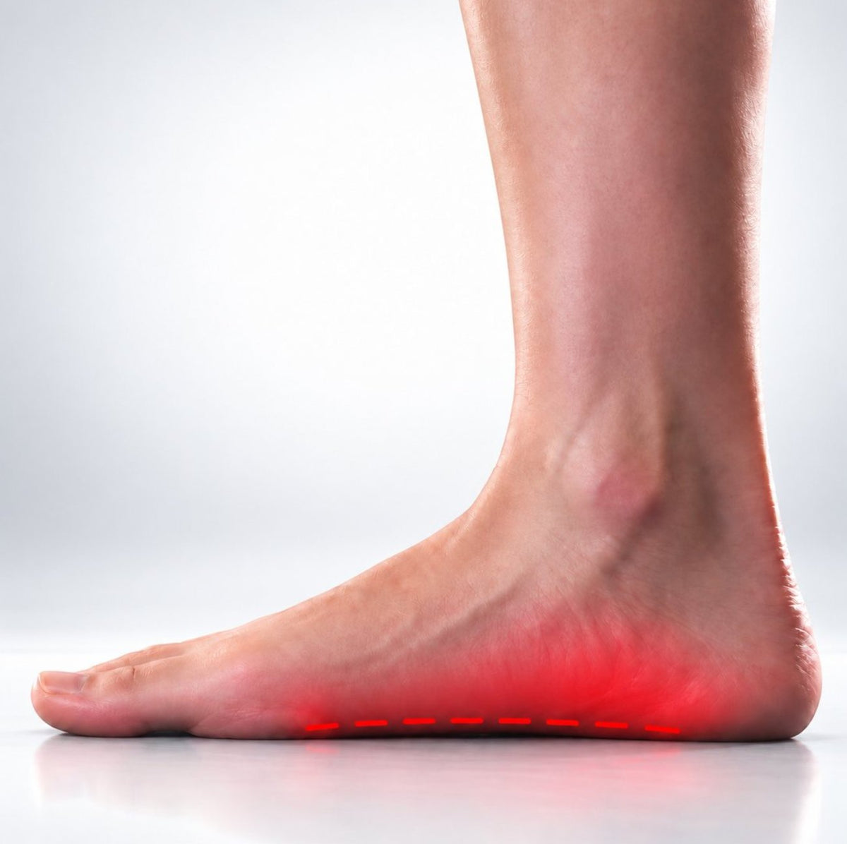 Side view of a foot with the sole highlighted
