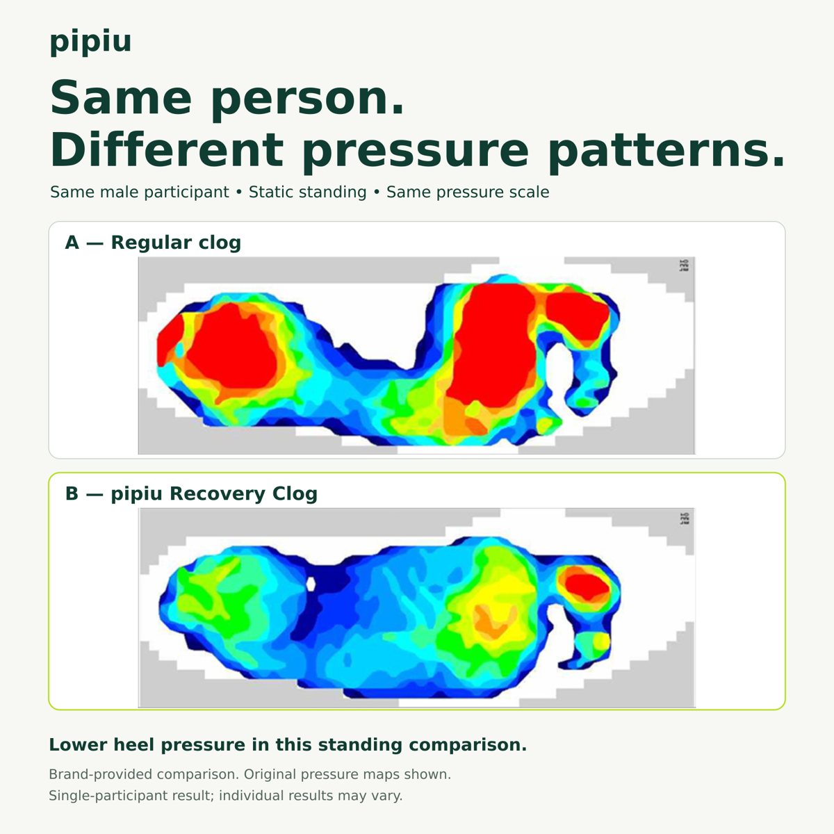 A: regular clog. B: pipiu Recovery Clog. Foot-pressure maps from the same participant standing still, same scale.